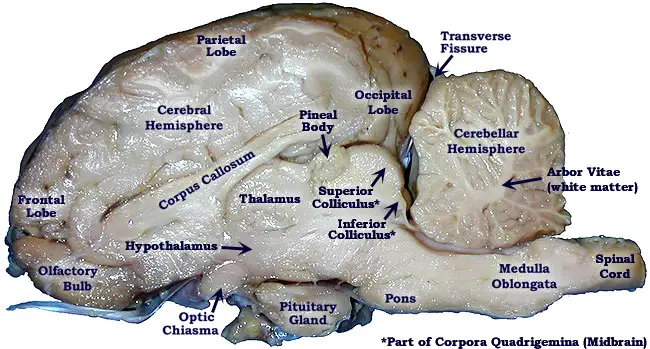 Pickled Sheep Brain-mid-saggital view
