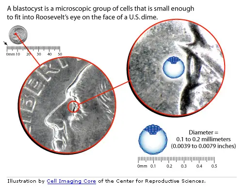 graphic of ruler with dime and blastocyst