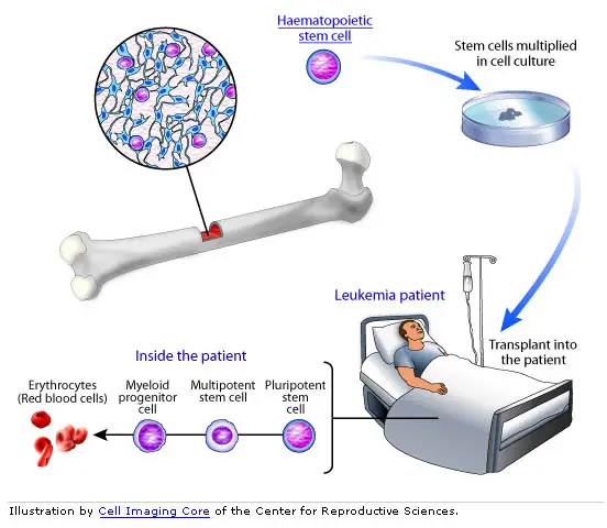 bone marrow stem cell graphic
