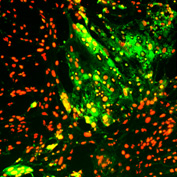 stem cell colonies